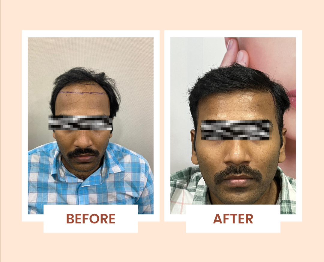 Beige Minimalist House Before After Instagram Post - 1