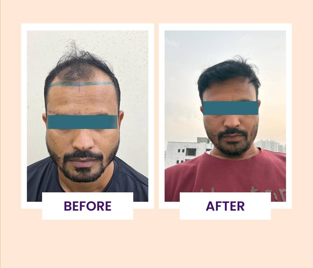 Beige Minimalist House Before After Instagram Post (3)