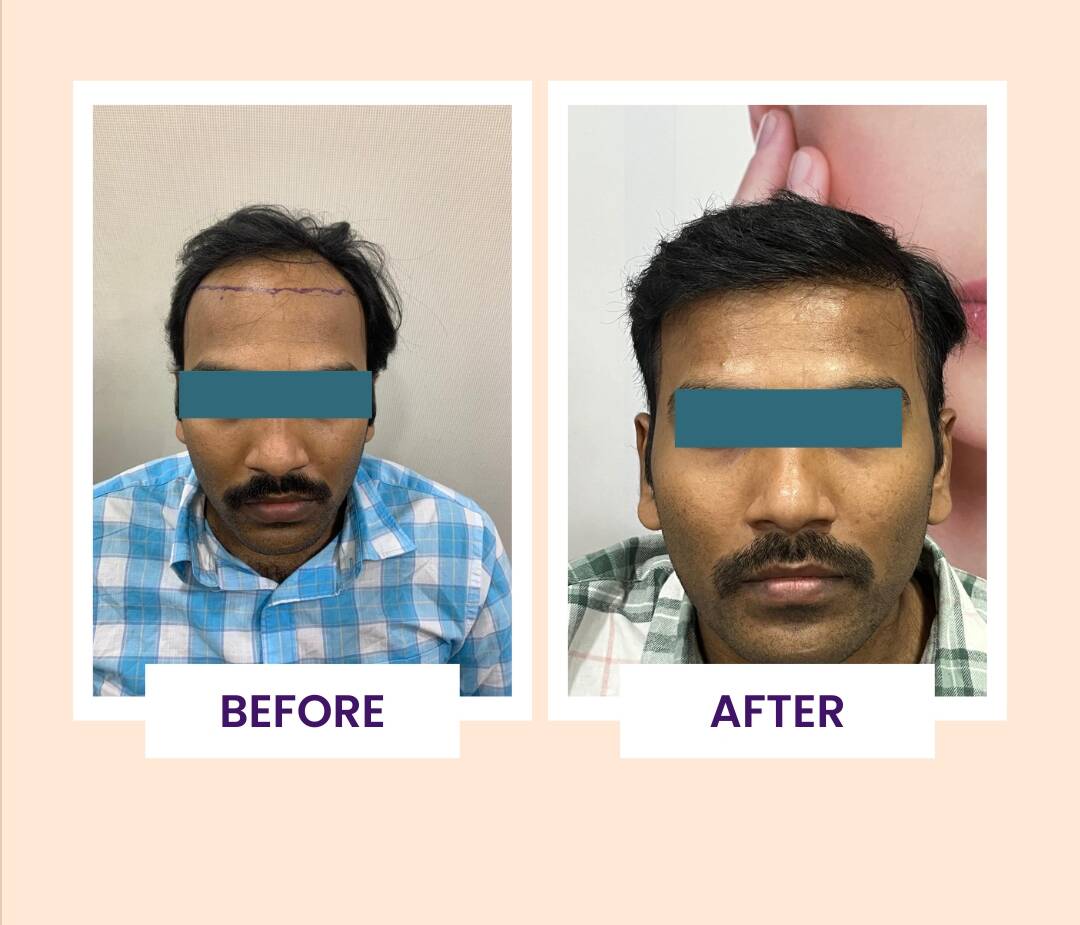 Beige Minimalist House Before After Instagram Post (4)